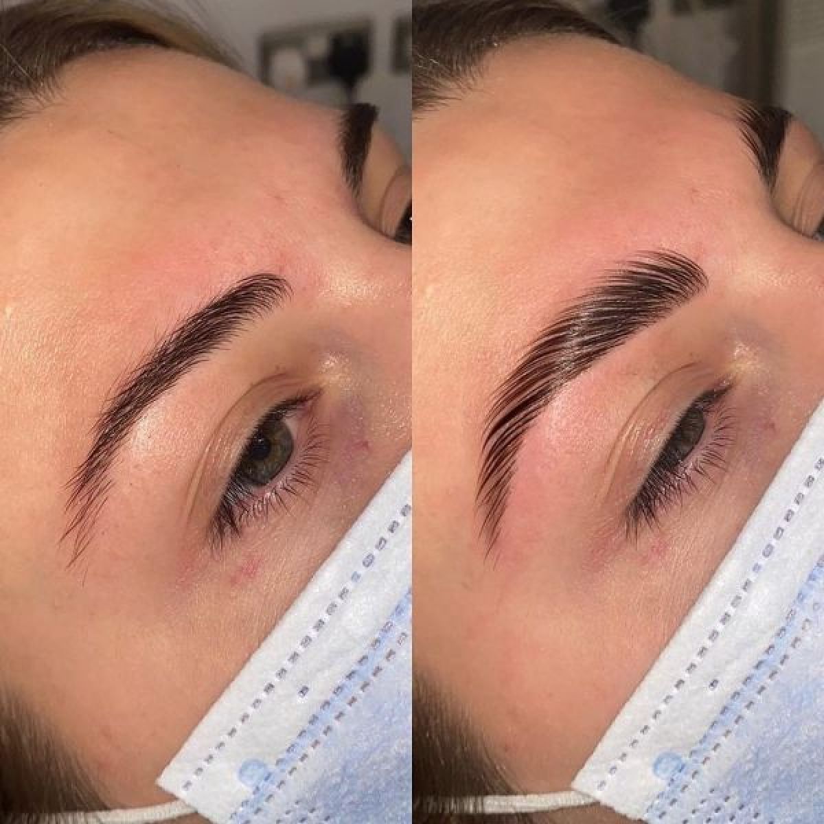 Browlift : Tout savoir sur la tendance pour des sourcils parfaitement sculptés