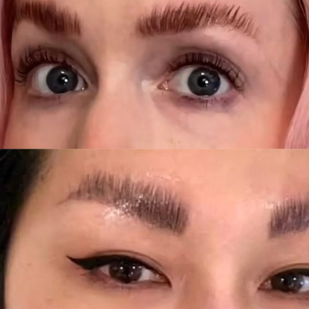 Comment rattraper un browlift raté ? 🔄