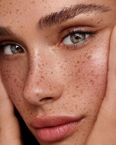 FORMATION FRECKLES / TÂCHES DE ROUSSEUR - 1 JOUR